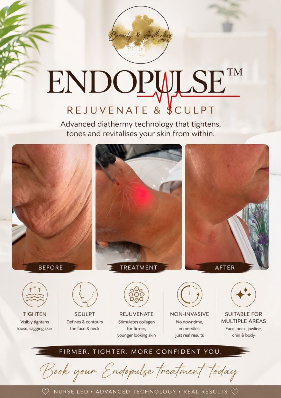 Endopulse™ treatment information from Beauty and Aesthetics by MK